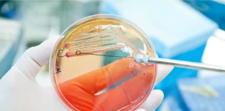 Geschlechtsunterschiede bei E.coli-Antibiotikaresistenzen bei Harnwegsinfekten