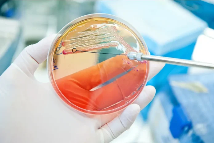 Geschlechtsunterschiede bei E.coli-Antibiotikaresistenzen bei Harnwegsinfekten