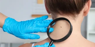 Studie: Nicotinamid kann Rezidivrisiko bei Hautkrebs senken