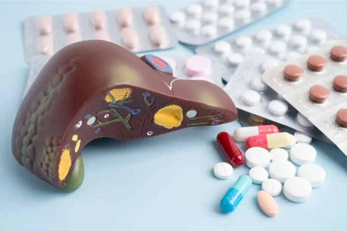 Neue Therapien gegen entzündliche Fettleber (MASH)