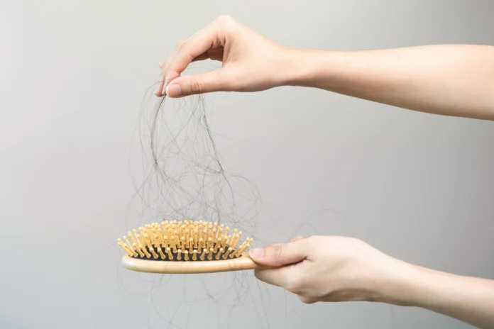 Haarausfall: Viele Haare bleiben in einer Bürste hängen – Symbolbild für Alopecia Universalis