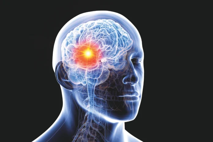 Clusterkopfschmerzen betreffen meist einseitig die Schläfen- und Augenregion – der Schmerz wird als extrem stechend empfunden.