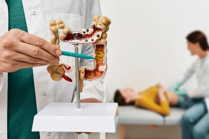 Modell des Darms mit Darstellung von Tumoren zur Veranschaulichung der Metastasierung bei Darmkrebs