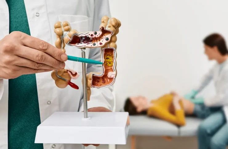 Modell des Darms mit Darstellung von Tumoren zur Veranschaulichung der Metastasierung bei Darmkrebs