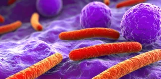 Illustration von Bakterien im Tumorgewebe: Tumormikrobiota beeinflusst Tumorbiologie und Immunantwort