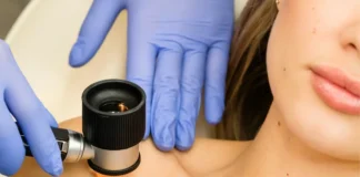 Dermatologische Untersuchung eines Muttermals mit einem Dermatoskop zur Früherkennung von weißem Hautkrebs.