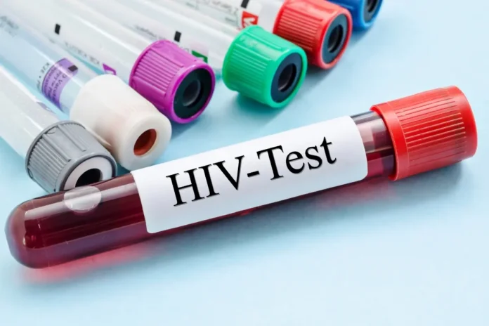 Blutröhrchen für einen HIV-Test