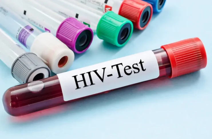 Blutröhrchen für einen HIV-Test